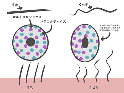 くせ毛の原因